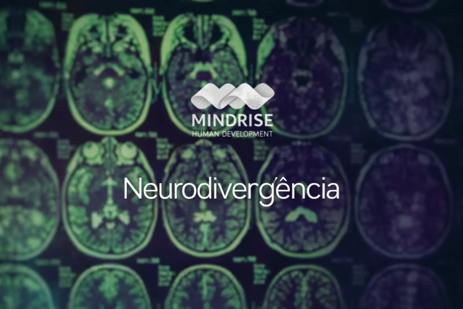 Neurodivergência — compreender, respeitar e valorizar diferentes formas de ser e pensar | MindRise